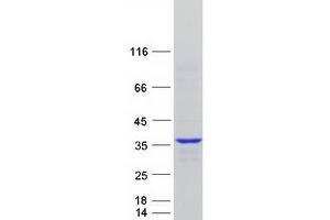 Validation with Western Blot (Cyclin Y Protein (CCNY) (Transcript Variant 2) (Myc-DYKDDDDK Tag))