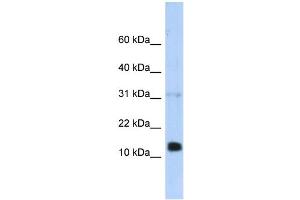 WB Suggested Anti-REG1B Antibody Titration:  0. (REG1B antibody  (N-Term))