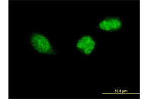 Immunofluorescence of purified MaxPab antibody to ZWINT on HeLa cell. (ZWINT antibody  (AA 1-277))