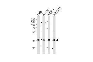 N Antibody (ABIN1882271 and ABIN2843406) western blot analysis in Hela,Jurkat,MCF-7,mouse NIH/3T3 cell line lysates (35 μg/lane).