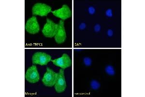 ABIN6391351 Immunofluorescence analysis of paraformaldehyde fixed U2OS cells, permeabilized with 0. (TRPC1 antibody  (Internal Region))