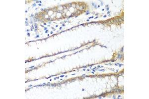 Immunohistochemistry of paraffin-embedded human stomach using PPP4R1 antibody. (PPP4R1 antibody  (AA 324-647))