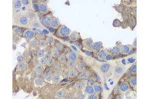 Immunohistochemistry analysis of paraffin-embedded mouse testis using FAS Monoclonal Antibody at dilution of 1:200. (FAS antibody)