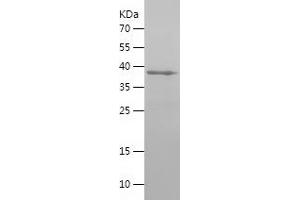 Western Blotting (WB) image for Doublecortin-Like Kinase 1 (DCLK1) (AA 586-740) protein (His-IF2DI Tag) (ABIN7284013) (DCLK1 Protein (AA 586-740) (His-IF2DI Tag))