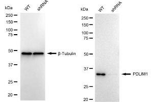 Western blotting analysis using PDLIM1 antibody (ABIN7799748).
