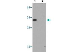 Western blot analysis of RILP in A-20 cell lysate with RILP polyclonal antibody  at 1 ug/mL. (RILP antibody  (Internal Region))