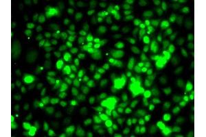 Immunofluorescence analysis of MCF7 cells using TCEB3 antibody (ABIN6131620, ABIN6148938, ABIN6148939 and ABIN6222760). (TCEB3 antibody  (AA 679-798))