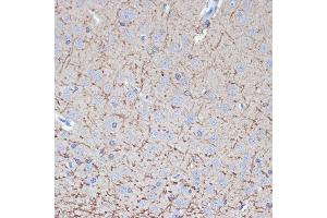 Immunohistochemistry of paraffin-embedded rat brain using TMOD2 Rabbit mAb (ABIN7271011) at dilution of 1:100 (40x lens). (TMOD2 antibody)
