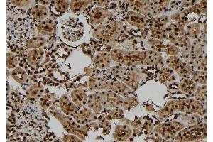 ABIN6277780 at 1/100 staining Rat kidney tissue by IHC-P. (PKC epsilon antibody  (pSer729))