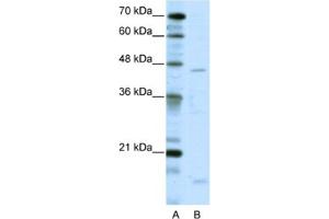 Western Blotting (WB) image for anti-Thyroid Hormone Receptor Interactor 13 (TRIP13) antibody (ABIN2461719) (TRIP13 antibody)