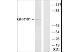 Western blot analysis of extracts from COS7 cells, using GPR101 Antibody.