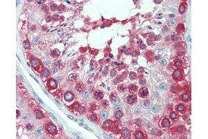 Anti-TCP1 antibody IHC staining of human testis. (TCP1 alpha/CCTA antibody  (AA 1-557))