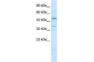 WB Suggested Anti-ZNF358 Antibody Titration:  1.