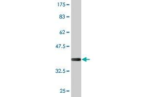 Western Blot detection against Immunogen (37. (PRRX2 antibody  (AA 151-253))
