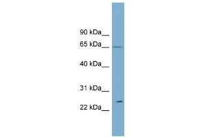 WB Suggested Anti-RPN2 Antibody Titration:  0. (Ribophorin II antibody  (Middle Region))