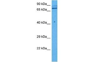 Host:  Rabbit  Target Name:  TGM2  Sample Tissue:  Mouse Skeletal Muscle  Antibody Dilution:  1ug/ml (Transglutaminase 2 antibody  (N-Term))