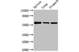 Western Blot Positive WB detected in: Mouse spleen tissue, Mouse lung tissue, Mouse stomach tissue All lanes: Glp1r antibody at 3 μg/mL Secondary Goat polyclonal to rabbit IgG at 1/50000 dilution Predicted band size: 54 kDa Observed band size: 54 kDa (GLP1R antibody  (AA 22-145))