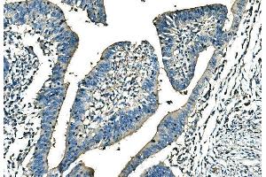 IHC analysis of Ankyrin Erythroid/ANK/ANK1 using anti-Ankyrin Erythroid/ANK/ANK1 antibody (ABIN7599959). (Erythrocyte Ankyrin antibody  (AA 1300-1844))
