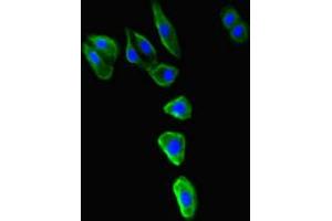 Immunofluorescence analysis of HepG2 cells, using MR1 antibody (1/100 dilution) and AF488-conjugated Goat anti-Rabbit IgG (H+L) secondary antibody. (MR1 antibody  (AA 150-253))