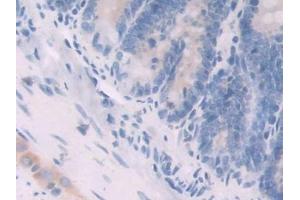 IHC-P analysis of Rat Small intestine Tissue, with DAB staining. (Neuregulin 1 antibody  (AA 328-486))