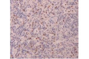 IHC-P analysis of Human Spleen Tissue, with DAB staining. (FLG2 antibody  (AA 1222-1368))