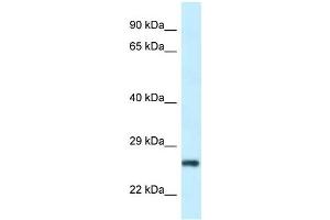 Western Blot showing RPS9 antibody used at a concentration of 1 ug/ml against Hela Cell Lysate (RPS9 antibody  (N-Term))