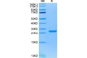 Human NGAL on Tris-Bis PAGE under reduced condition. (Lipocalin 2 Protein (LCN2) (AA 21-198) (His tag))