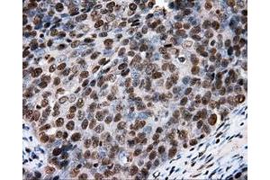 Immunohistochemical staining of paraffin-embedded colon tissue using anti-RC204952 mouse monoclonal antibody. (XRCC1 antibody)