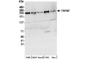 Western Blotting (WB) image for anti-Transient Receptor Potential Cation Channel, Subfamily M, Member 7 (TRPM7) (AA 1815-1865) antibody (ABIN7450962) (TRPM7 antibody  (AA 1815-1865))