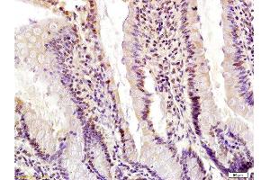 Formalin-fixed and paraffin embedded rat small intestine labeled with Anti-Egr1 Polyclonal Antibody, Unconjugated  at 1:200 followed by conjugation to the secondary antibody and DAB staining. (EGR1 antibody  (AA 401-453))