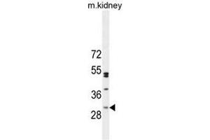 CF062 Antibody (Center) western blot analysis in mouse kidney tissue lysates (35µg/lane). (C6ORF62 antibody  (Middle Region))