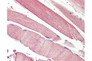 Anti-THNSL2 antibody IHC staining of human skeletal muscle. (THNSL2 antibody  (AA 192-204))