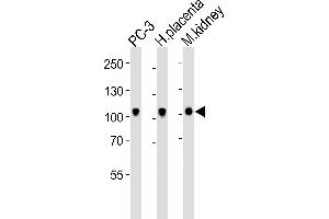 Western blot analysis of lysates from PC-3 cell line, human placenta, mouse kidney tissue lysate (from left to right), using Ephb4 Antibody (C-term) (ABIN6243858 and ABIN6577663). (EPH Receptor B4 antibody  (C-Term))