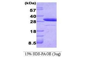 Figure annotation denotes ug of protein loaded and % gel used. (Latexin Protein (LXN) (AA 1-222))
