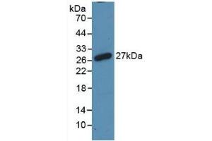 Detection of Recombinant RANk, Rat using Polyclonal Antibody to Receptor Activator Of Nuclear Factor Kappa B (RANk) (TNFRSF11A antibody  (AA 31-214))