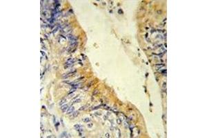 Image no. 2 for anti-Medium-Chain Specific Acyl-CoA Dehydrogenase, Mitochondrial (AA 196-225) antibody (ABIN452704) (Medium-Chain Specific Acyl-CoA Dehydrogenase, Mitochondrial (AA 196-225) antibody)