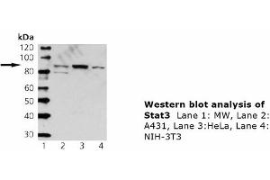 Image no. 1 for anti-Signal Transducer and Activator of Transcription 3 (Acute-Phase Response Factor) (STAT3) antibody (ABIN331480) (STAT3 antibody)