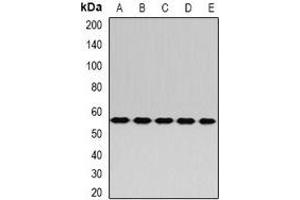 Western blot analysis of RABIN3 expression in Hela (A), A549 (B), mouse kidney (C), mouse liver (D), rat brain (E) whole cell lysates. (RAB3IP antibody)