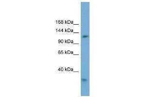 Western Blot showing RFC1 antibody used at a concentration of 1-2 ug/ml to detect its target protein. (RFC1 antibody  (Middle Region))