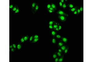 Immunofluorescence staining of HepG2 cells with ABIN7171330 at 1:100, counter-stained with DAPI. (TAL1 antibody  (AA 1-114))