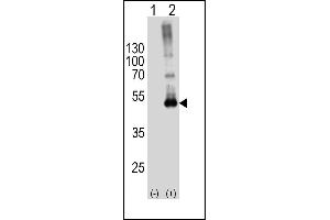 Western blot analysis of SPHK1-M1 Antibody (arrow) using rabbit polyclonal SPHK1-M1 Antibody (ABIN391345 and ABIN2841366). (SPHK1 antibody  (N-Term))