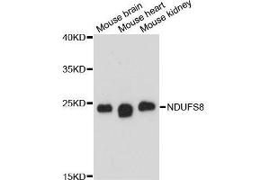 Western blot analysis of extracts of various cell lines, using NDUFS8 antibody. (NDUFS8 antibody  (AA 35-210))