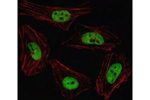 Fluorescent image of HeLa cell stained with PITX2 antibody. (PITX2 antibody  (AA 122-151))