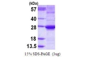SDS-PAGE (SDS) image for ADP-Ribosylation Factor-Like 15 (ARL15) (AA 1-204) protein (His tag) (ABIN667965) (ARL15 Protein (AA 1-204) (His tag))