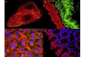 ATTO dyes can be used for multicolor immunofluorescent detection with low background and high signal. (AKT1 antibody  (Internal Region, pSer473) (Atto 594))