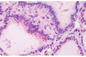Human Thyroid: Formalin-Fixed, Paraffin-Embedded (FFPE) (UBE2N antibody  (AA 40-51))