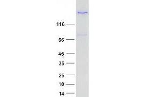 Validation with Western Blot (LTBP3 Protein (Transcript Variant 1) (Myc-DYKDDDDK Tag))