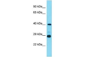 Host: Rabbit  Target Name: Lhfpl3  Sample Tissue: Mouse Heart lysates  Antibody Dilution: 1. (LHFPL3 antibody  (C-Term))
