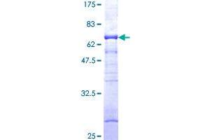 PRKAG1 Protein (AA 1-331) (GST tag)