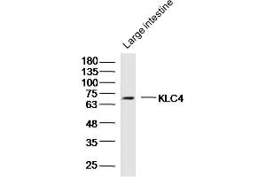 Mouse large intestine lysates probed with KLC4 Polyclonal Antibody, Unconjugated  at 1:300 dilution and 4˚C overnight incubation.